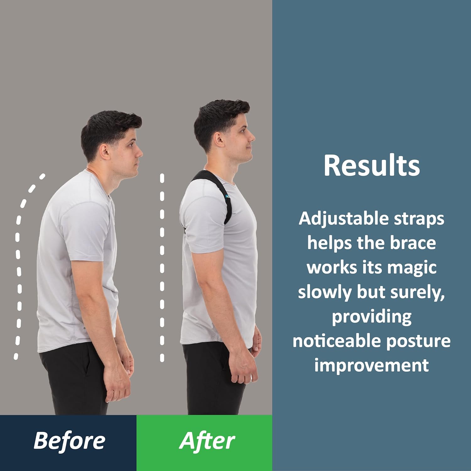 ComfortPro Posture Brace