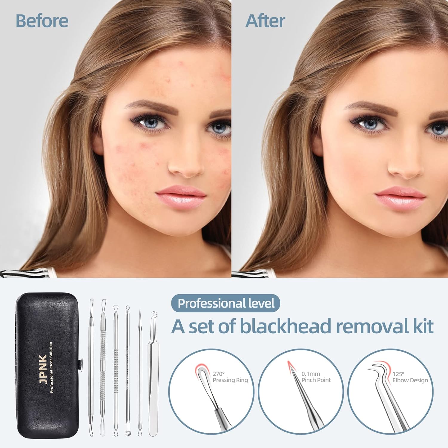 Clear Skin Care Kit