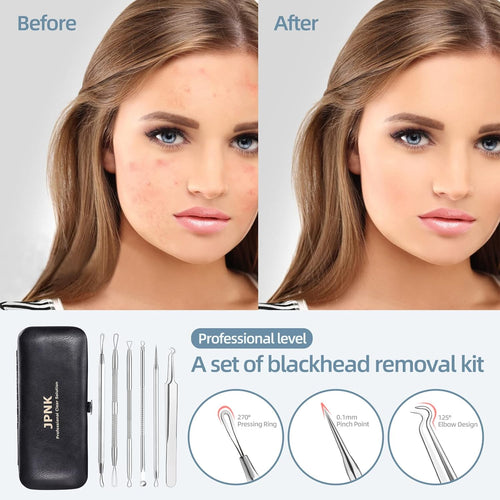 Clear Skin Care Kit